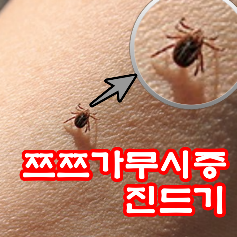 쯔쯔가무시증 진드기